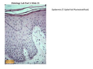 Epidermis (T. Epitel·lial Pluriestratificat)
 