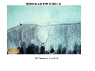 Cèl. Secretora intestinal
 