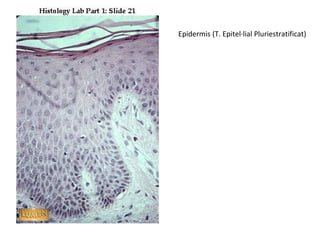 Epidermis (T. Epitel·lial Pluriestratificat)
 