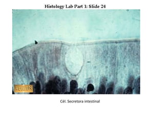 Cèl. Secretora intestinal
 