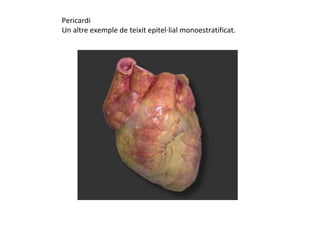 Pericardi
Un altre exemple de teixit epitel·lial monoestratificat.
 