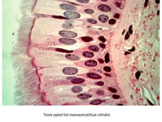 Teixit epitel·lial monoestratificat cilíndric
 