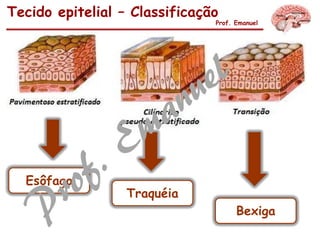 Tecido epitelial – Classificação
Prof. Emanuel
Bexiga
Esôfago
Traquéia
 