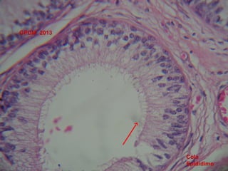 GPDM 2013

Cola
Epidídimo

 