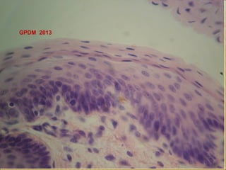 GPDM 2013

 