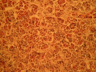 Epitelial cubierta y revestimiento