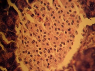 Epitelial cubierta y revestimiento