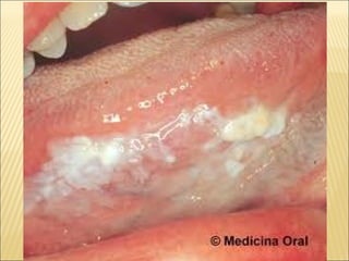 Epitelial cubierta y revestimiento