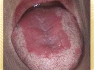 Epitelial cubierta y revestimiento