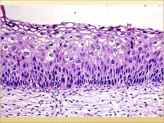 Epitelial cubierta y revestimiento