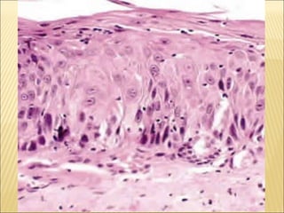 Epitelial cubierta y revestimiento