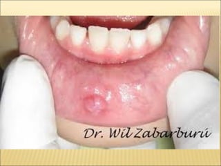 Epitelial cubierta y revestimiento