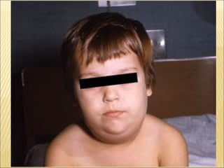 Epitelial cubierta y revestimiento