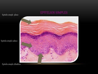 EPITELIOS SIMPLES Epitelio simple plano 
Epitelio simple cubico 
Epitelio simple cilíndrico 
 