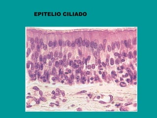 EPITELIO CILIADO 