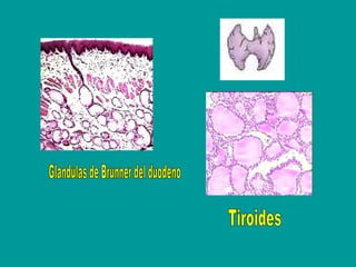 Glandulas de Brunner del duodeno Tiroides 