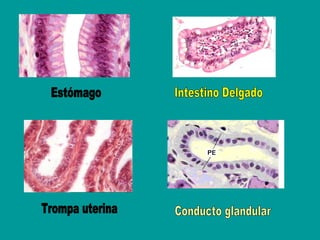 Estómago Intestino Delgado Trompa uterina Conducto glandular 