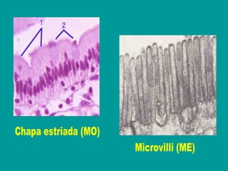 Microvilli (ME) Chapa estriada (MO) 