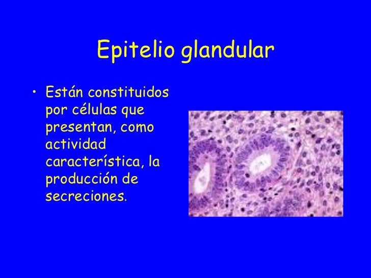 Epitelio glandular