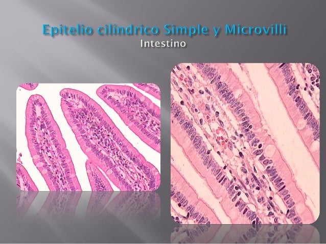 Epitelio de revestimiento y glandular