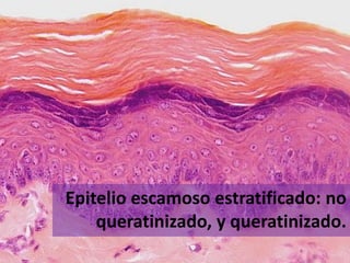 Epitelio escamoso estratificado: no
    queratinizado, y queratinizado.
 