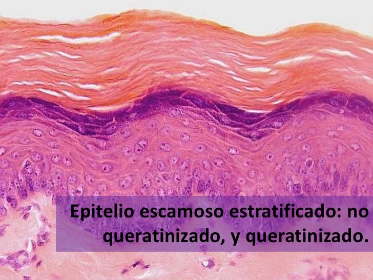 Epitelio escamoso estratificado