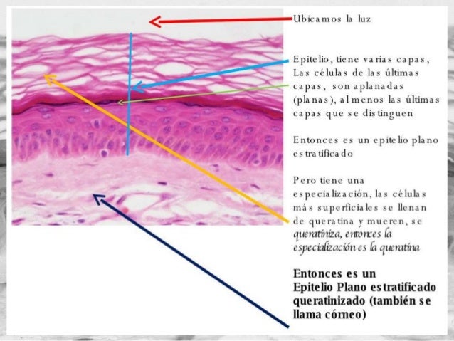 Filamento O Parte Muy Delgada De Una Cosa