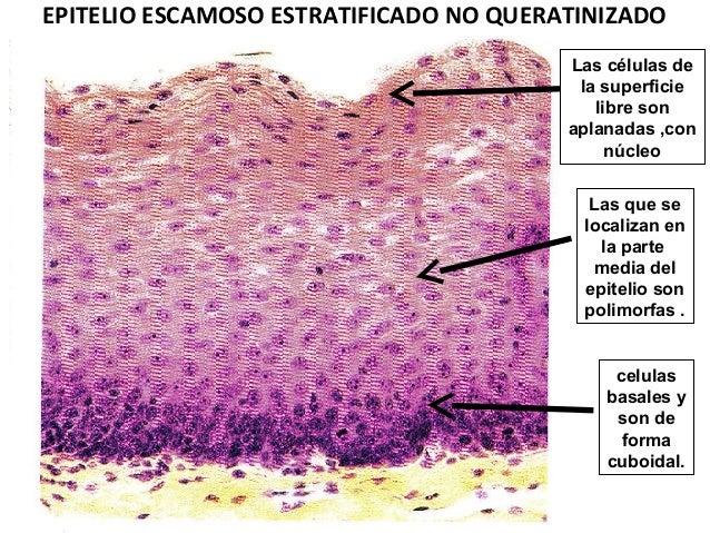 Epitelio Plano Estratificado No Queratinizado Partes