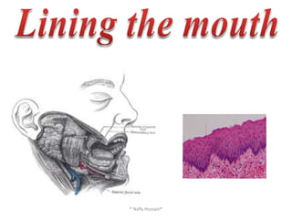 Squamous Epithelia:Structure Simple Squamous Epitheliaconsist of a single layer of flattened cells and it has a    nucleus. It’s shape is rather like crazy paving. Stratified Squamous Epithelia  has many layers of flattened cells.* Nafly Hussain*