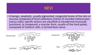 Epithelial Disorders Oral Pathology | PPTX