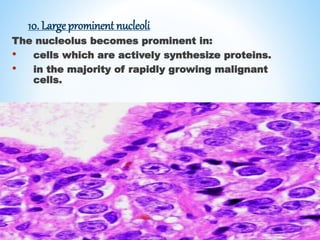 10. Large prominent nucleoli
The nucleolus becomes prominent in:
• cells which are actively synthesize proteins.
• in the majority of rapidly growing malignant
cells.
 