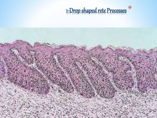 *1-Drop shaped reteProcesses
 