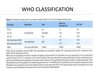 Epithelial neuroendocrine neoplasia (5).pptx