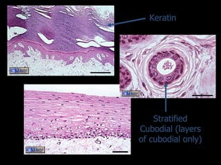 Keratin Stratified Cubodial (layers of cubodial only) 