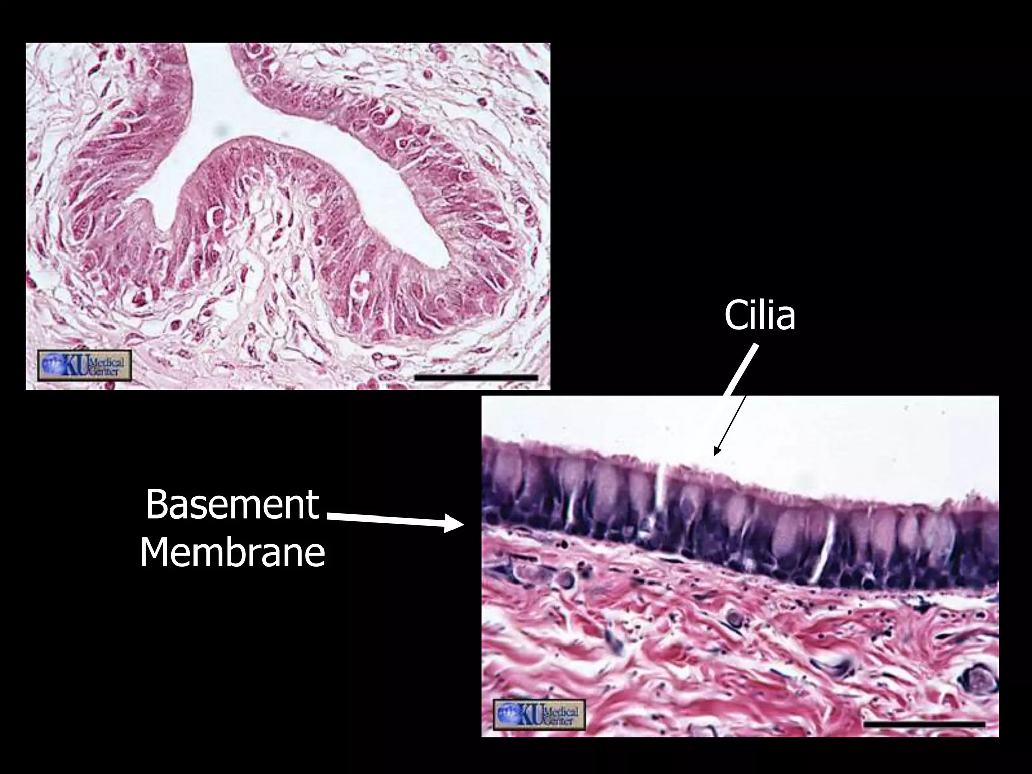 Cilia
Basement
Membrane
 