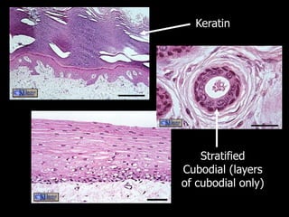 Keratin
Stratified
Cubodial (layers
of cubodial only)
 