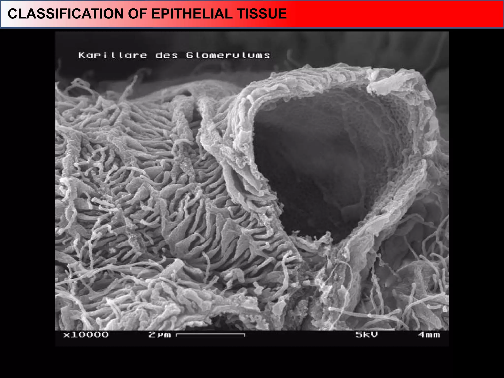 CLASSIFICATION OF EPITHELIAL TISSUE
 
