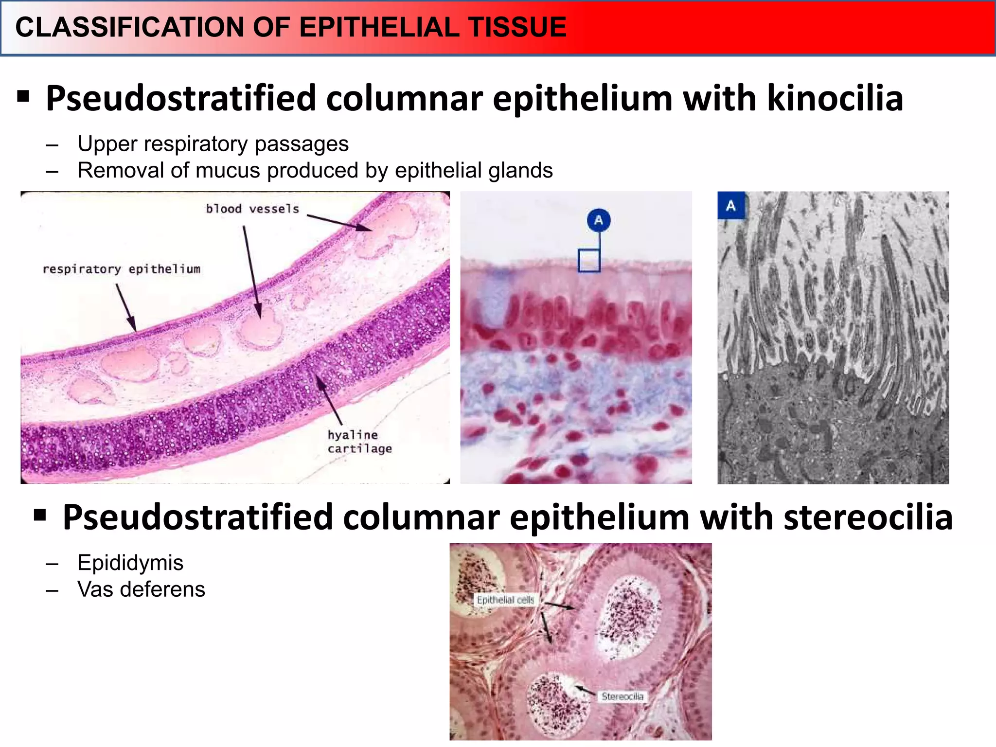  Pseudostratified columnar epithelium with kinocilia
‒ Upper respiratory passages
‒ Removal of mucus produced by epithelial glands
‒ Epididymis
‒ Vas deferens
CLASSIFICATION OF EPITHELIAL TISSUE
 Pseudostratified columnar epithelium with stereocilia
 