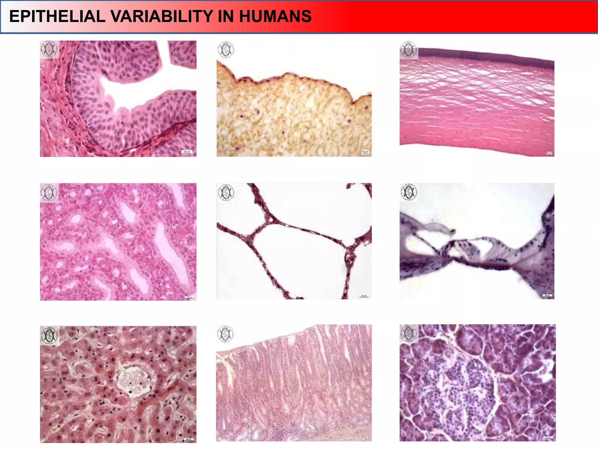 EPITHELIAL VARIABILITY IN HUMANS
 