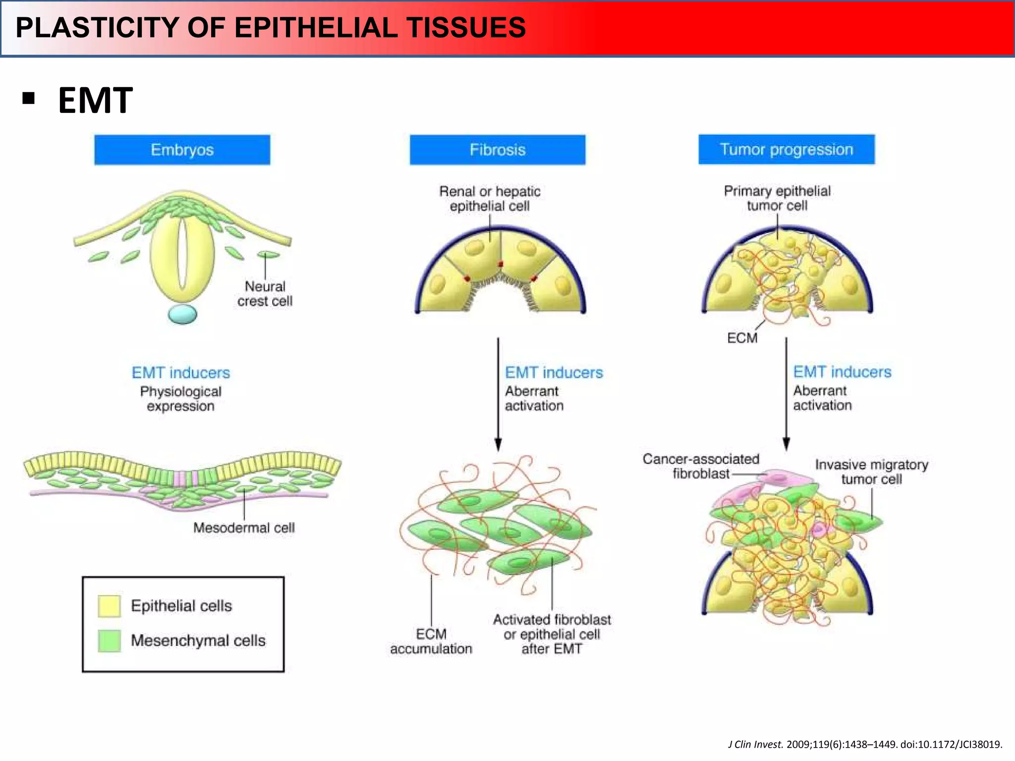 J Clin Invest. 2009;119(6):1438–1449. doi:10.1172/JCI38019.
 EMT
PLASTICITY OF EPITHELIAL TISSUES
 