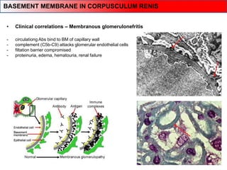 • Clinical correlations – Membranous glomerulonefritis
- circulationg Abs bind to BM of capillary wall
- complement (C5b-C9) attacks glomerular endothelial cells
- filtation barrier compromised
- proteinuria, edema, hematouria, renal failure
BASEMENT MEMBRANE IN CORPUSCULUM RENIS
 