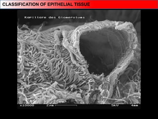 CLASSIFICATION OF EPITHELIAL TISSUE
 