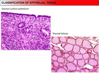Ovarian surface epithelium
Thyroid follicles
CLASSIFICATION OF EPITHELIAL TISSUE
 