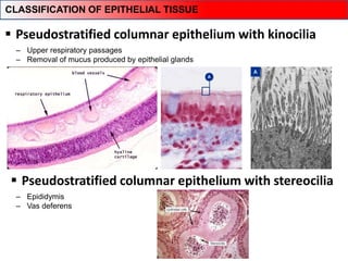  Pseudostratified columnar epithelium with kinocilia
‒ Upper respiratory passages
‒ Removal of mucus produced by epithelial glands
‒ Epididymis
‒ Vas deferens
CLASSIFICATION OF EPITHELIAL TISSUE
 Pseudostratified columnar epithelium with stereocilia
 