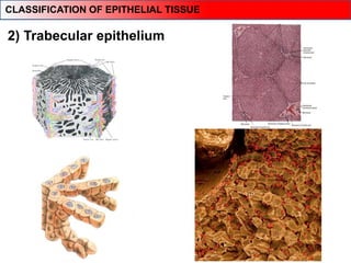 2) Trabecular epithelium
Liver parenchyma
CLASSIFICATION OF EPITHELIAL TISSUE
 
