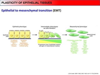 Epithelial to mesenchymal transition (EMT)
J Clin Invest. 2009;119(6):1420–1428. doi:10.1172/JCI39104.
PLASTICITY OF EPITHELIAL TISSUES
 