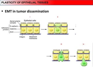  EMT in tumor dissemination
PLASTICITY OF EPITHELIAL TISSUES
 