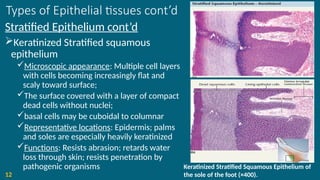 Types of Epithelial tissues cont’d
Stratified Epithelium cont’d
Keratinized Stratified squamous
epithelium
Microscopic appearance: Multiple cell layers
with cells becoming increasingly flat and
scaly toward surface;
The surface covered with a layer of compact
dead cells without nuclei;
basal cells may be cuboidal to columnar
Representative locations: Epidermis; palms
and soles are especially heavily keratinized
Functions: Resists abrasion; retards water
loss through skin; resists penetration by
pathogenic organisms
12
Keratinized Stratified Squamous Epithelium of
the sole of the foot (×400).
 