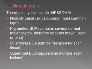 Epithelial tumours of oral cavity | PPTX