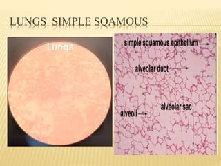 LUNGS SIMPLE SQAMOUS
 